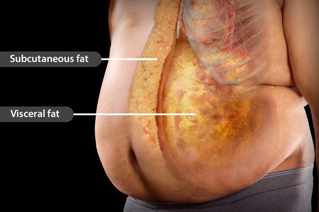 Belly fat diet weight loss mauritius